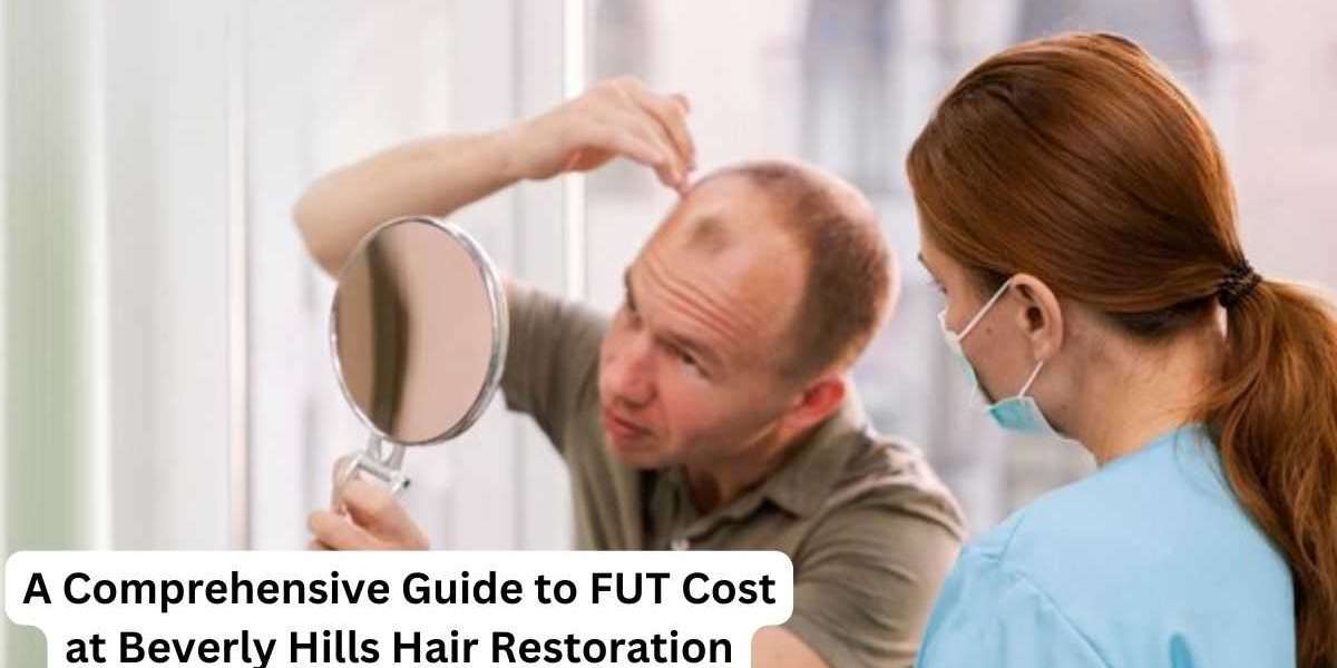 A Comprehensive Guide to FUT Cost at Beverly Hills Hair Restoration