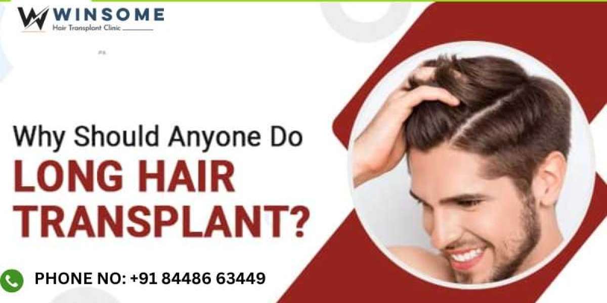 Why Should Anyone Do Long Hair Transplant Know More Details?