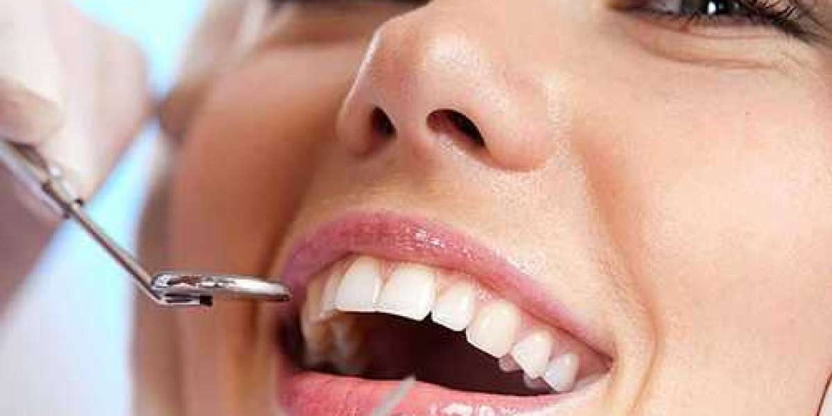 Rediscover Confidence with Permanent Dentures in Odessa