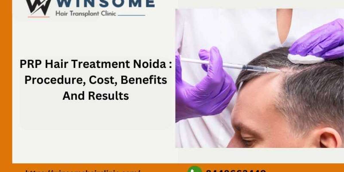 PRP Hair Treatment Noida : Procedure, Cost, Benefits And Results