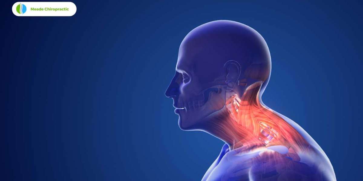 Understanding Humpback Neck: Causes, Symptoms, and Treatments